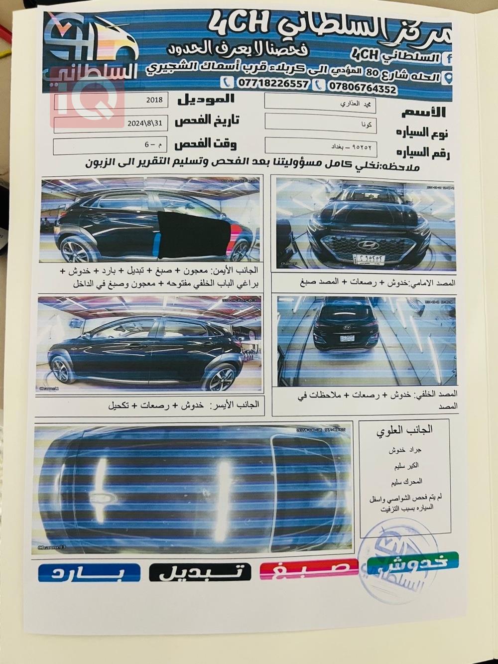 هیوندای کۆنا